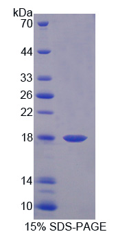 Recombinant Monokine Induced By Interferon Gamma (MIg)