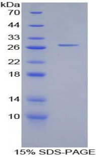 Recombinant Cathepsin S (CTSS)