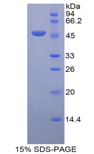 Recombinant Leucine Rich Alpha-2-Glycoprotein 1 (LRG1)