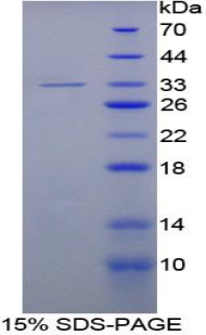 Recombinant Leucine Rich Alpha-2-Glycoprotein 1 (LRG1)