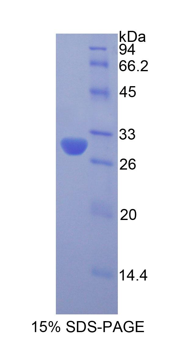 Recombinant Acrosin (ACR)