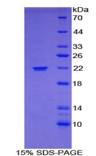 Recombinant Monoamine Oxidase A (MAOA)