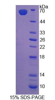 Recombinant Monoamine Oxidase A (MAOA)