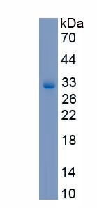 Recombinant Interferon Regulatory Factor 6 (IRF6)