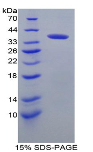 Recombinant Interferon Regulatory Factor 6 (IRF6)