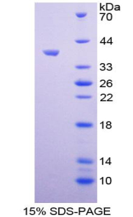 Recombinant Arachidonate-12-Lipoxygenase (ALOX12)