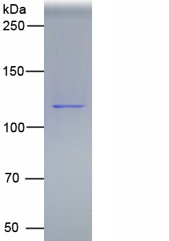 Recombinant Syndecan 1 (SDC1)
