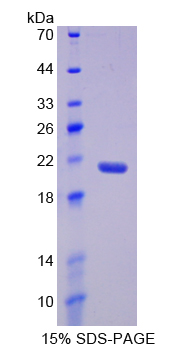 Recombinant Complement Component 5 (C5)