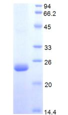 Recombinant Protein S (PROS)