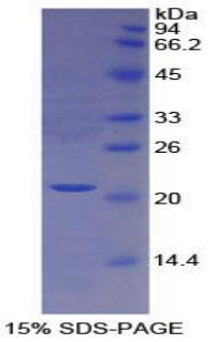 Recombinant Protein S (PROS)