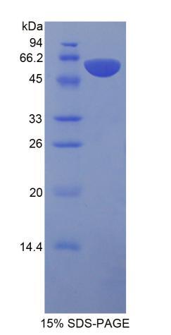 Recombinant Protein S (PROS)