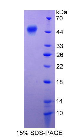 Recombinant Pigment Epithelium Derived Factor (PEDF)