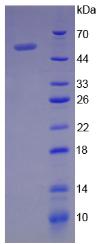 Recombinant Pigment Epithelium Derived Factor (PEDF)