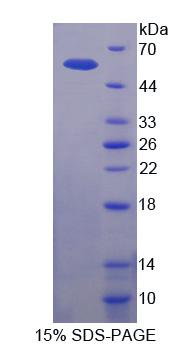 Recombinant Pigment Epithelium Derived Factor (PEDF)