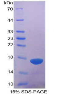 Recombinant A Disintegrin And Metalloproteinase With Thrombospondin 1 (ADAMTS1)