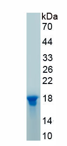 Recombinant A Disintegrin And Metalloproteinase With Thrombospondin 1 (ADAMTS1)