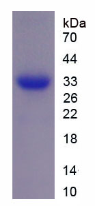 Recombinant A Disintegrin And Metalloproteinase With Thrombospondin 1 (ADAMTS1)