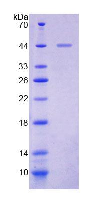 Recombinant Sodium Hydrogen Exchange Regulatory Cofactor 2 (SLC9A3R2)