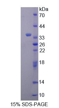 Recombinant Hepcidin (Hepc)