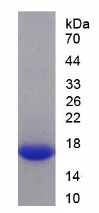 Recombinant Protein Kinase N2 (PKN2)