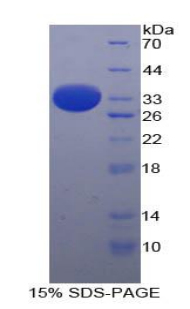 Recombinant Arrestin Beta 1 (ARRb1)