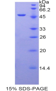 Recombinant Arrestin Beta 2 (ARRb2)