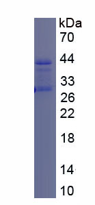 Recombinant Apolipoprotein C2 (APOC2)