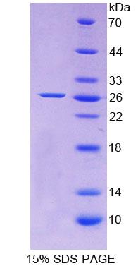 Recombinant Apolipoprotein A5 (APOA5)