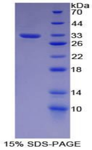 Recombinant Cadherin 16 (CDH16)