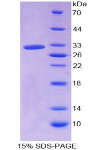 Recombinant Haptoglobin Related Protein (HPR)