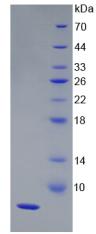 Recombinant Haptoglobin Related Protein (HPR)