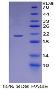 Recombinant Apolipoprotein B (APOB)