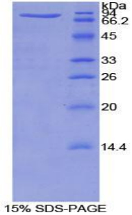 Recombinant Serpin A10 (SERPINA10)