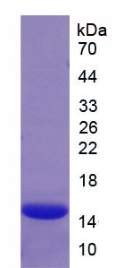 Recombinant Complement Factor B (CFB)