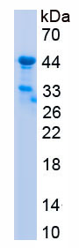 Recombinant Complement Factor B (CFB)