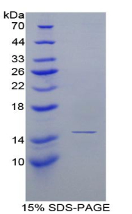 Recombinant Complement Factor B (CFB)