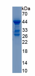 Recombinant Complement Factor B (CFB)