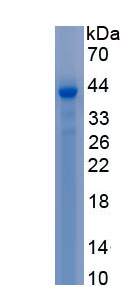 Recombinant Cytochrome P450 17A1 (CYP17A1)