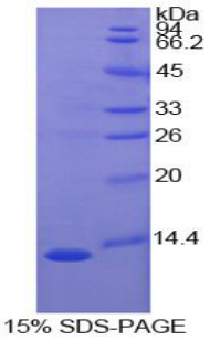 Recombinant S100 Calcium Binding Protein A4 (S100A4)