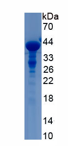 Recombinant Glucose Transporter 4 (GLUT4)