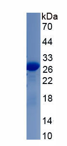 Recombinant Interleukin 4 Receptor (IL4R)