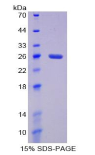 Recombinant Interleukin 4 Receptor (IL4R)