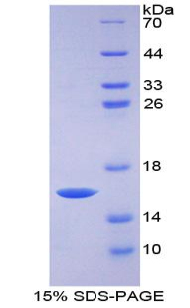 Recombinant Growth Differentiation Factor 15 (GDF15)