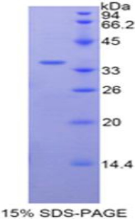 Recombinant Transferrin (TF)