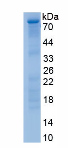 Recombinant Transferrin (TF)
