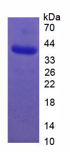 Recombinant Glucose Transporter 2 (GLUT2)