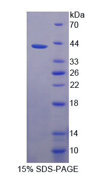 Recombinant Liver X Receptor Alpha (LXRa)