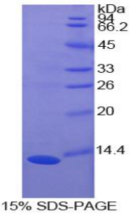 Recombinant S100 Calcium Binding Protein A10 (S100A10)