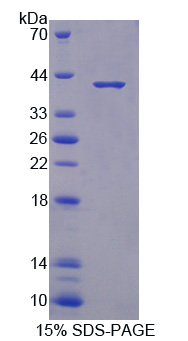 Recombinant S100 Calcium Binding Protein A10 (S100A10)