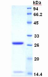 Recombinant Ki-67 Protein (Ki-67)